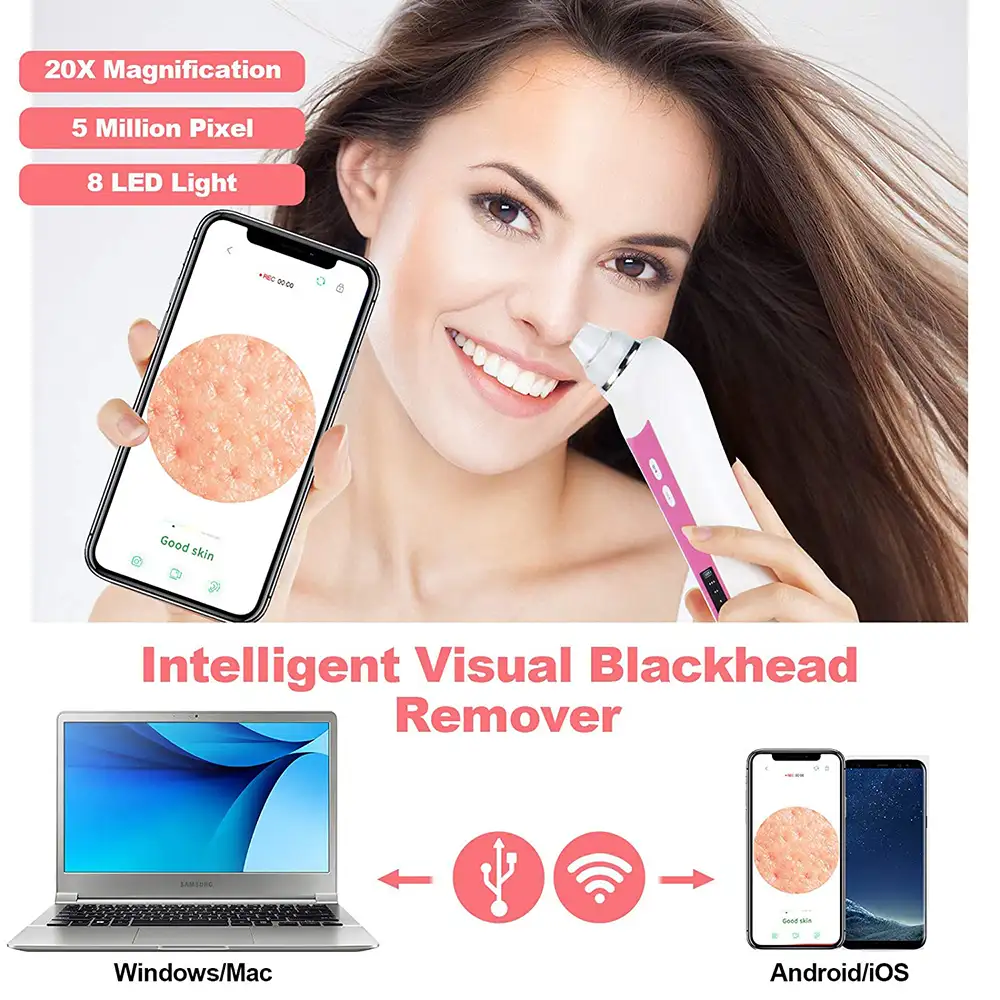 5MP WIFI 20X Magnification Blackhead Remover - Image 4