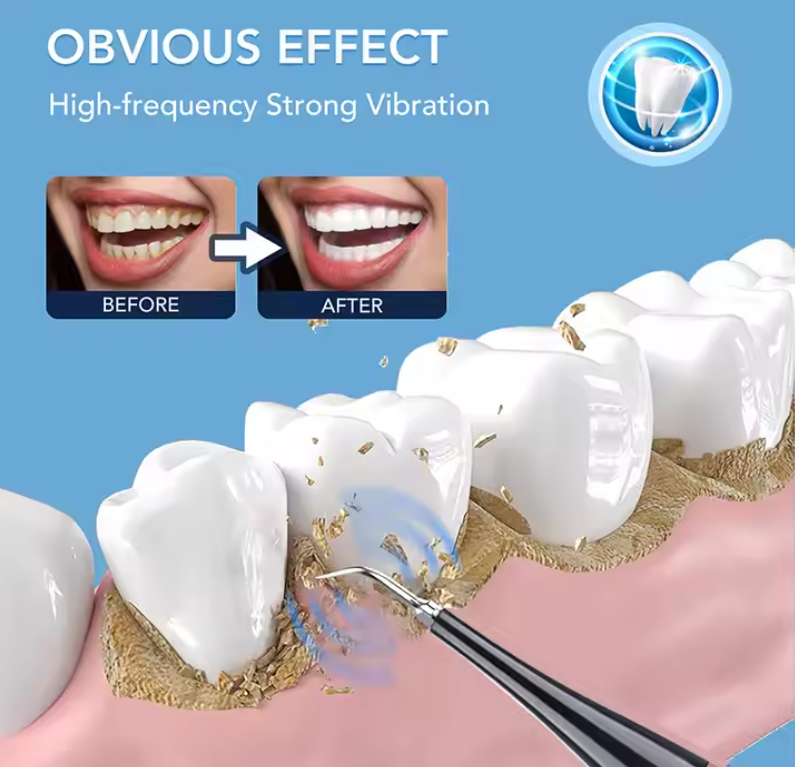 Electrical Dental Sonic Cleaning Device
